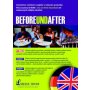 BEFOREundAFTER